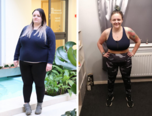 More about gastric sleeve surgery – Kirsty's Story » Bariatric Services